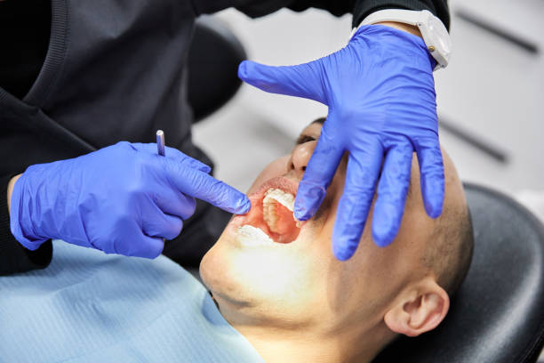 Best Walk-In Emergency Dental Services in Fredericktown, MO