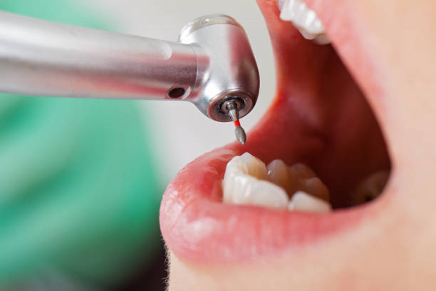 Best Emergency Treatment for Jaw Pain or Injury in Fredericktown, MO